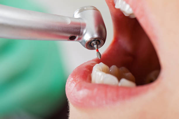 Best Emergency Root Canal Treatment in Emah, OK